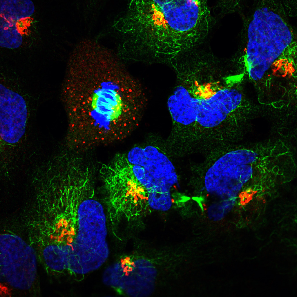 Development of intracellular drug delivery methods